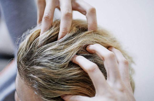 头皮长了个疙瘩破了怎么办,头皮为啥老长粉刺之类的疙瘩