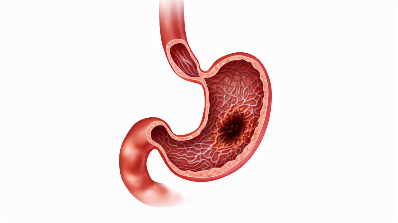 胃长期不舒服应该做什么检查,胃持续隐痛好几个月了一定是癌症