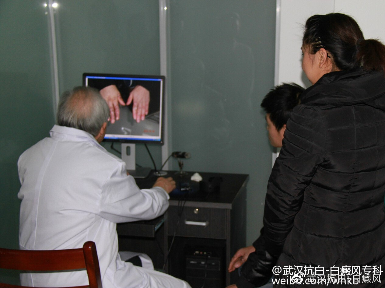 有几种方法可以治白癜风,这才是白癜风的最佳治疗方法