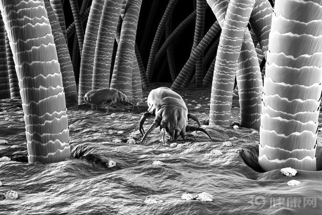 螨虫除不尽,螨虫怎么治疗可以除根不痒