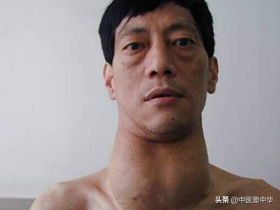 甲亢会引发糖尿病吗，这两个方面需要了解