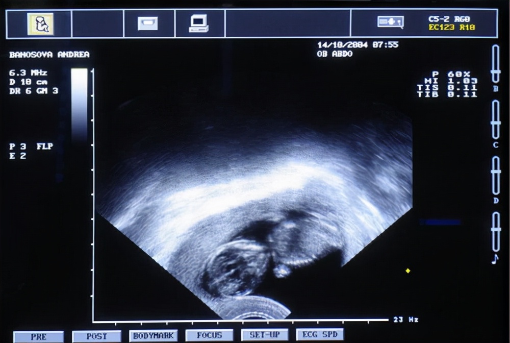 妇科阴式b超探头是一次性的吗,什么是阴超检查呀