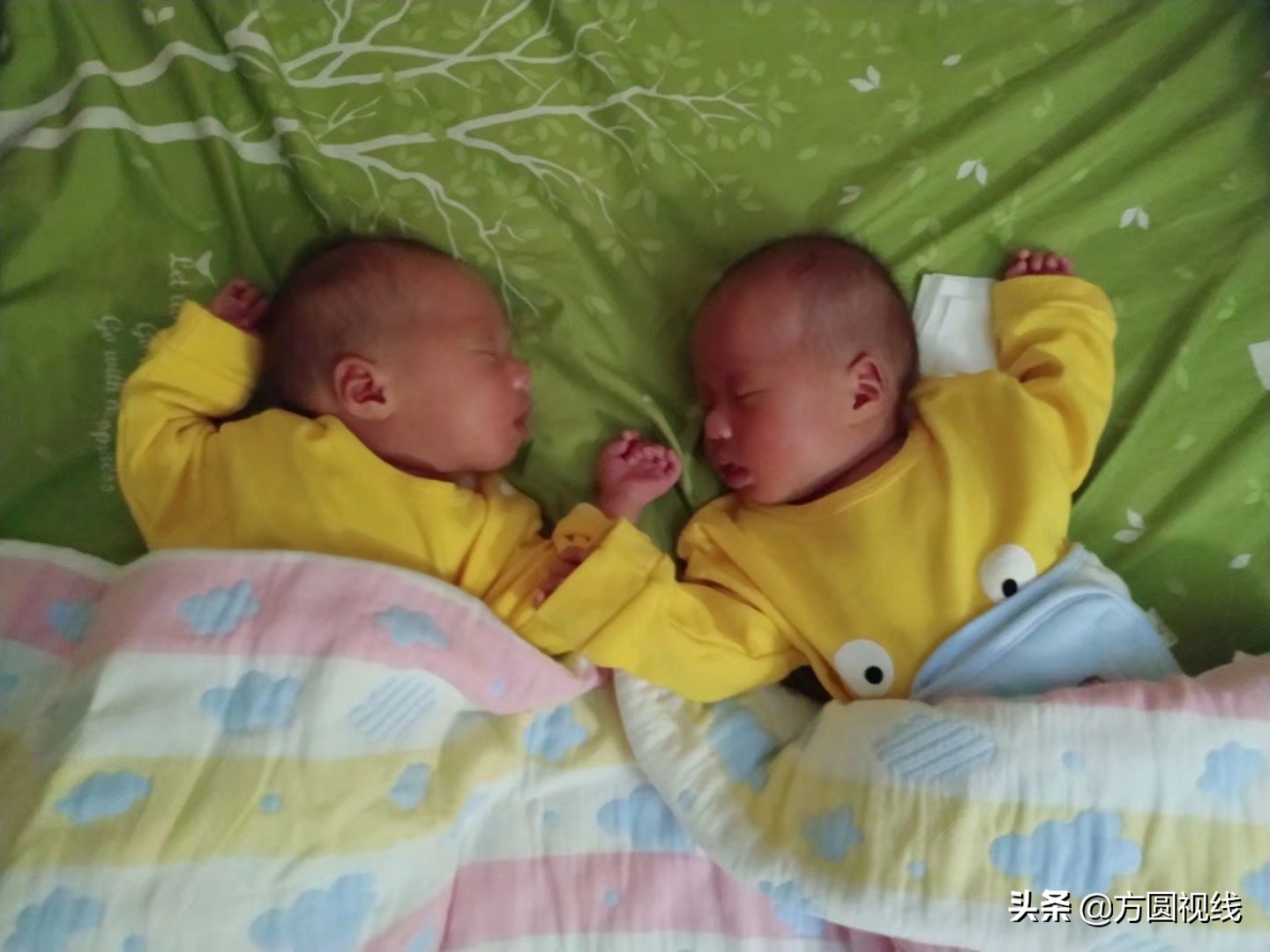 三胎意外怀上双胞胎是什么体验,二胎生下双胞胎男婴完整版