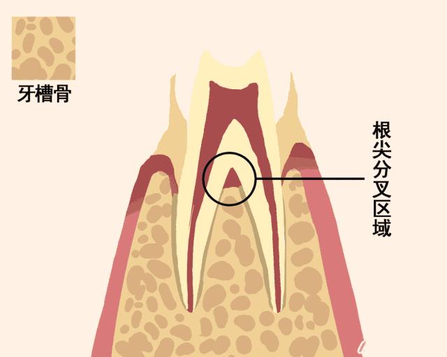 牙齿缺失10年倾斜脱落图,一张动图告诉你