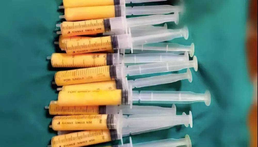 美颜都遮不住的法令纹该怎么回答,滤镜才是法令纹的天敌