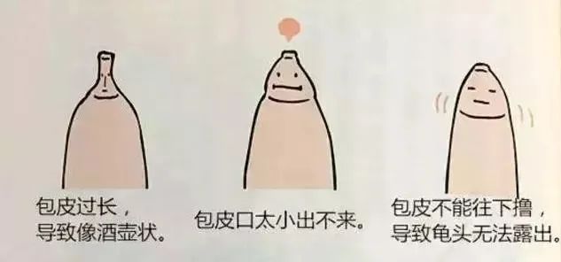 割包皮的几个棘手的情况,医院割包皮会不会被宰