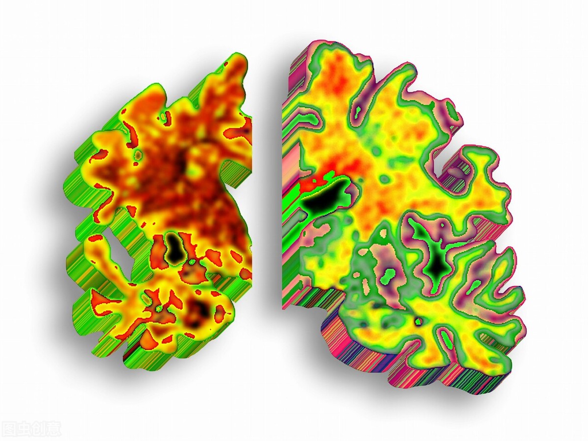 糖尿病周围神经病变的中医分型,糖尿病足神经病变治疗视频