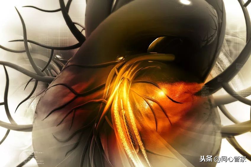 不想支架有必要做造影吗,不想脑出血脑梗心梗要注意什么