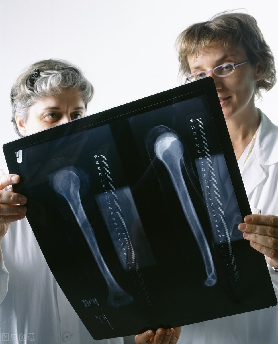 癌症骨转移要打骨头针吗,乳腺癌骨转移单纯是骨头疼吗