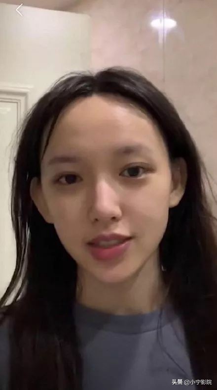 程潇发际线变高的原因为什么,程潇发际线怎么变低了