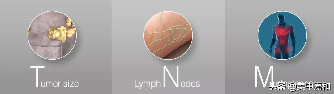 口腔肿瘤tnm分期标准,结肠肿瘤tnm分期标准