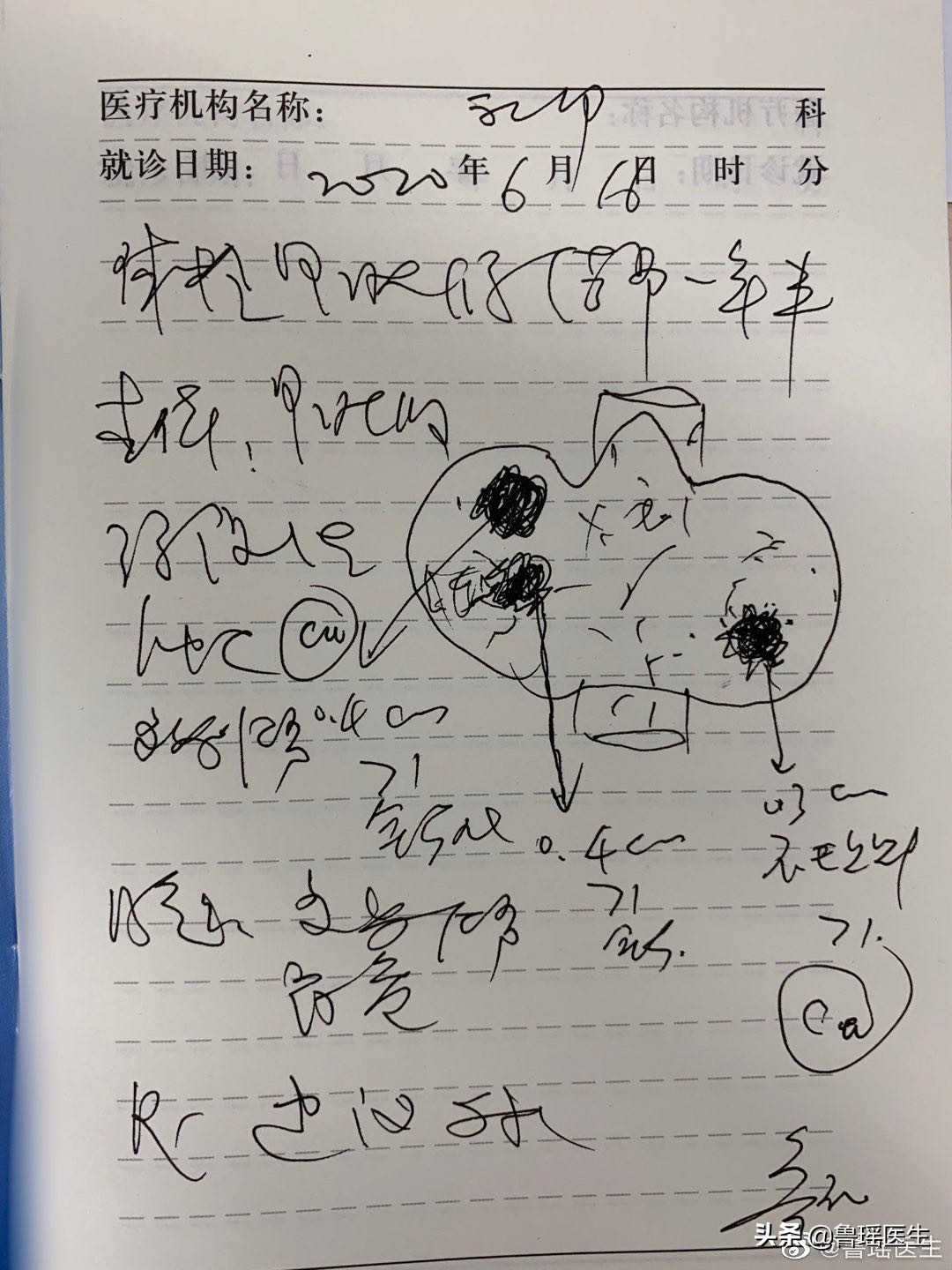 甲状腺穿刺报告可疑甲状腺癌,甲状腺穿刺报告写疑似恶性肿瘤