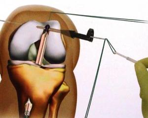 辟谣痛风喝酒,痛风辟谣