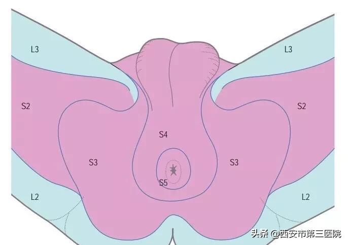 【医者解读】揭开“骶管囊肿”之神秘面纱，查出骶管囊肿都需要治疗吗？（手术病例+文献回顾）