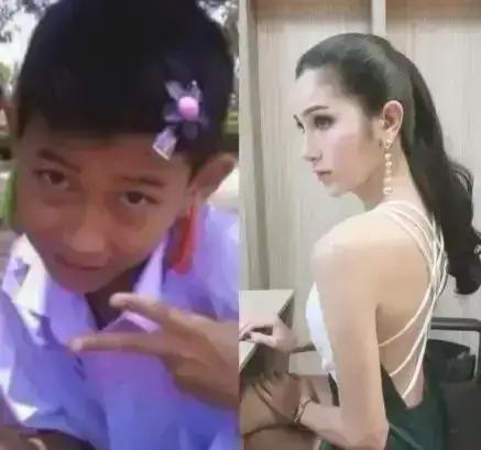 全球整容技术最好的地方,全球哪个国家整容行业最好