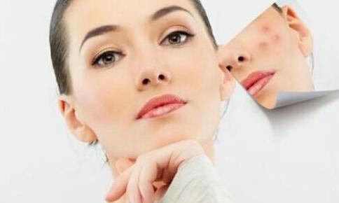 怎么祛痘印最快最有效的方法,如何快速祛痘印最有效的方法