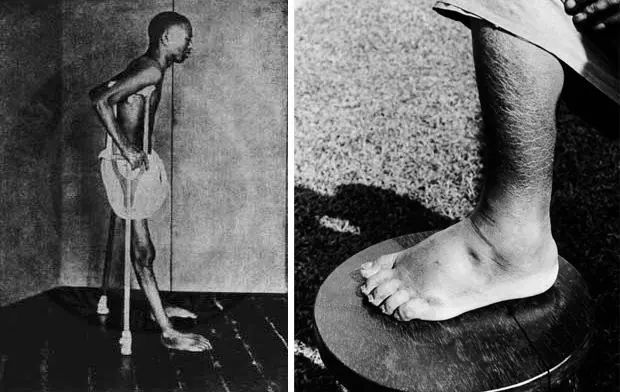 从日本皇室蔓延到*队军**的致命脚气，要找到真凶究竟有多难？