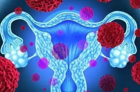 28岁女子查出宫颈癌的4个征兆,26岁女孩患有宫颈癌的原因
