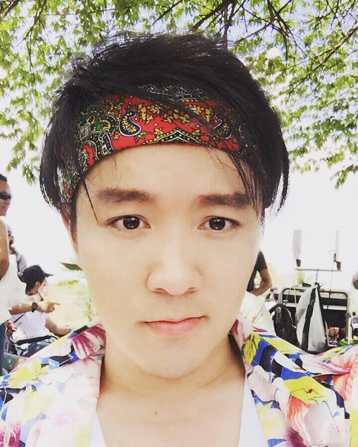 “三毛”34岁了！8岁爆火，14岁谢顶，植发挨300多针，如今变帅哥