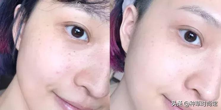 脸色暗黄干皮怎么变白最快方法,暗黄皮用什么护肤品变白