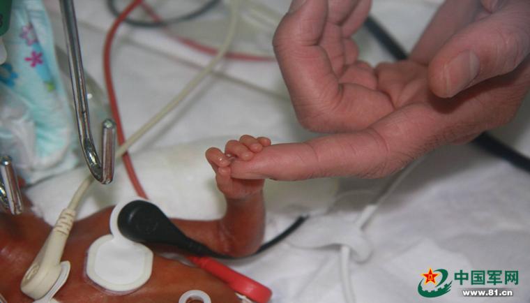 八一儿童医院救治小孩,八一陆军儿童医院