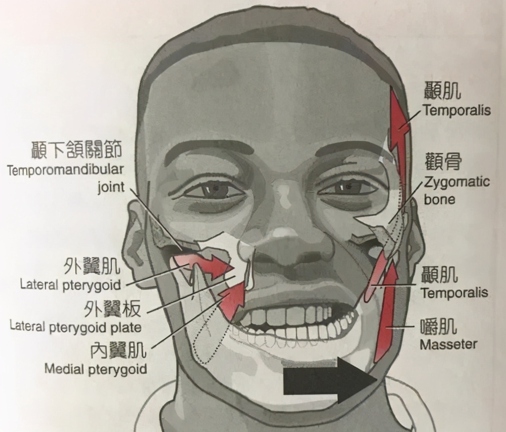 高颧骨脸型怎么变好看,脸型凹陷颧骨突出怎么矫正