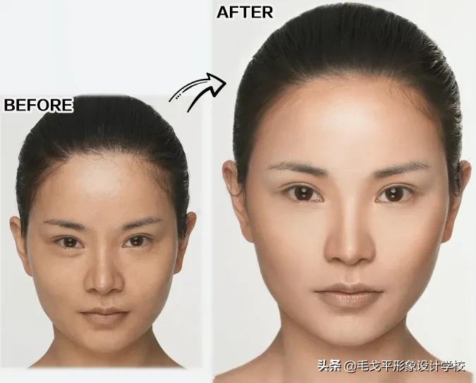 扁平的脸如何变立体微整,整骨脸变扁平怎么办