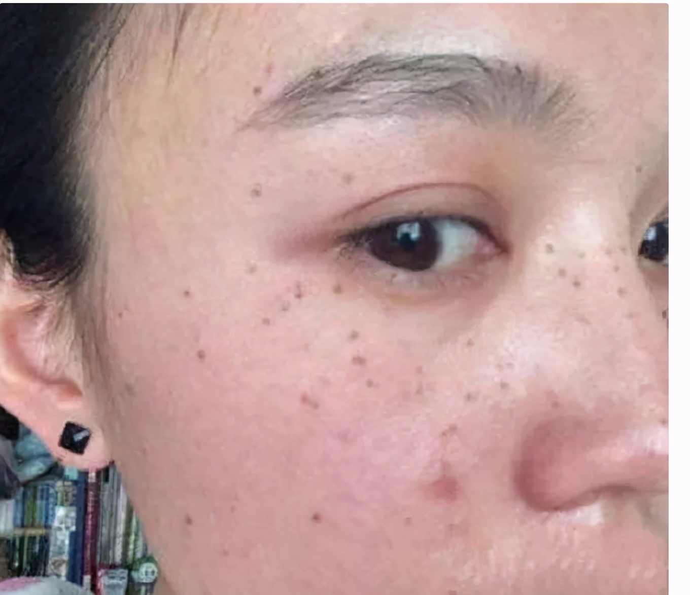 泽佳淡斑精华怎么样好用吗,泽佳淡斑精华好用吗怎么样