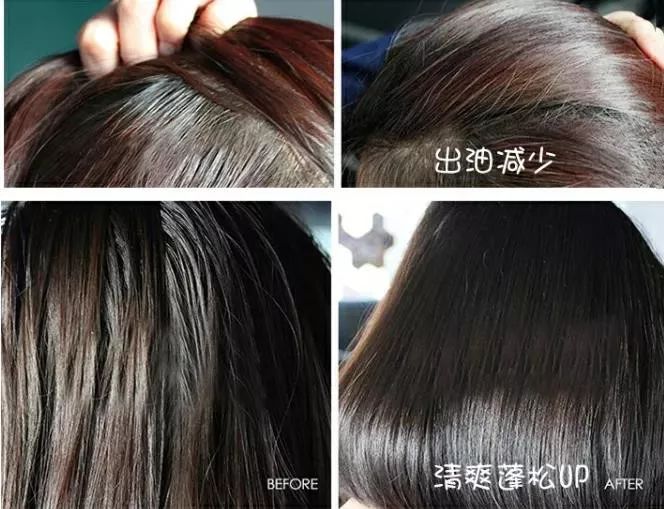 清爽头皮不掉发洗发露,洗发露去屑止痒留香持久干头发