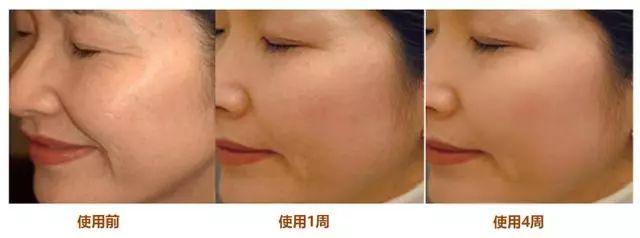 香港明星同款冻干面膜,各路明星推荐的面膜怎么样