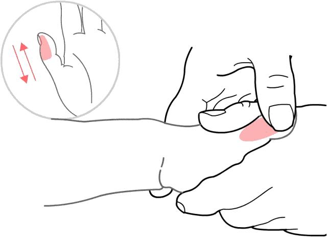 哮喘一停药就复发是怎么回事,哮喘儿童停药后复发的处理标准