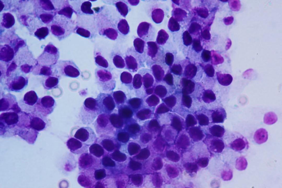 公狗前列腺增生囊肿一定要绝育吗,公狗前列腺炎需要做绝育手术吗