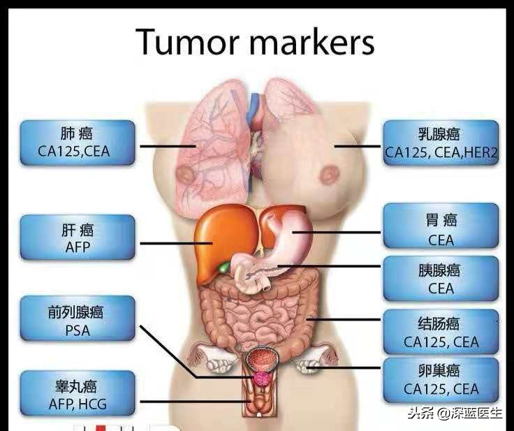 年年体检发现癌症时却已是晚期,年年体检都正常查出癌症却是晚期