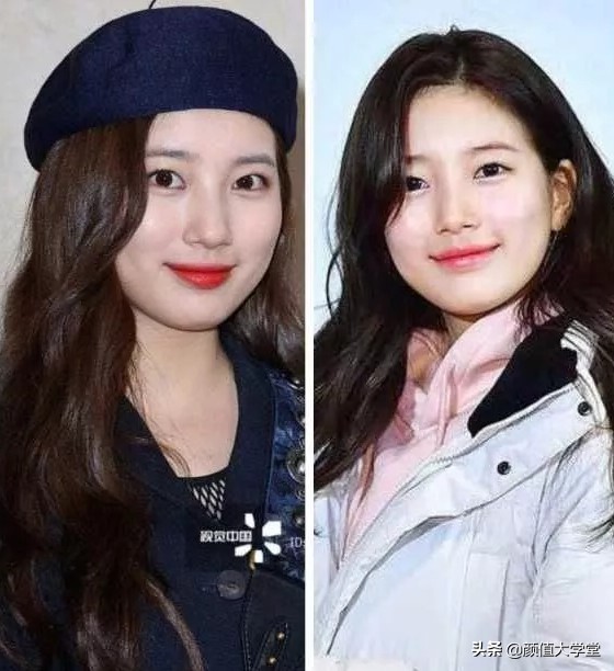 下巴后缩怎么拍侧颜,下巴后缩需要怎么矫正