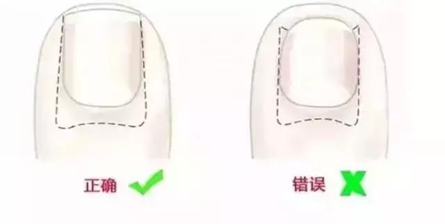 宝宝一个脚趾两个趾甲,心分享