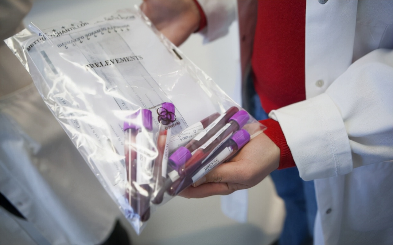 错把艾滋病当皮肤病,别错把艾滋当成皮肤病