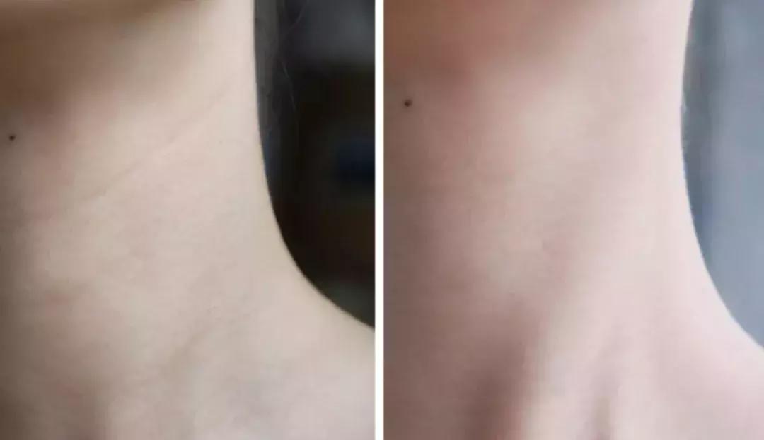 日常这些护肤误区千万不要踩,十大护肤烂脸成分