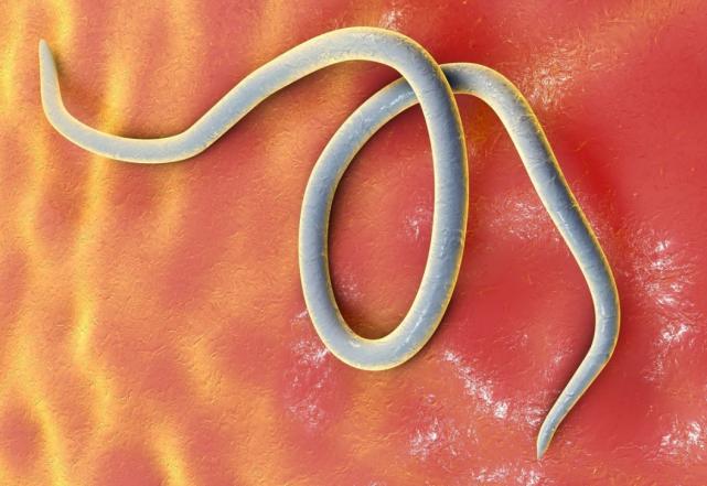 寄生虫放大1000倍你还敢吃吗,寄生虫是如何控制宿主大脑的