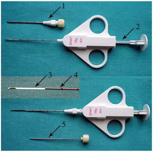 ct引导下穿刺活检诊断的分析,超声引导下穿刺活检什么样子的呢