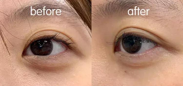 有了前法国第一夫人的百元“黑科技”眼霜,我把3000块眼霜扔了!