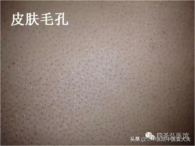 迈入中医之门第22篇：皮肤过敏