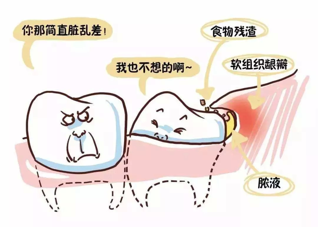 吃东西老是塞牙怎么都抠不出来,吃东西经常塞牙缝弄不出来怎么办