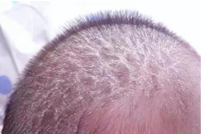 宝宝的哪个部位再脏也不能洗,婴儿身上的三个部位不能洗