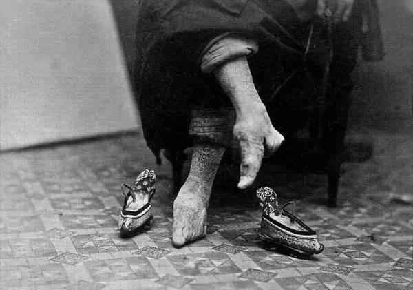 缠脚老奶，如今不再