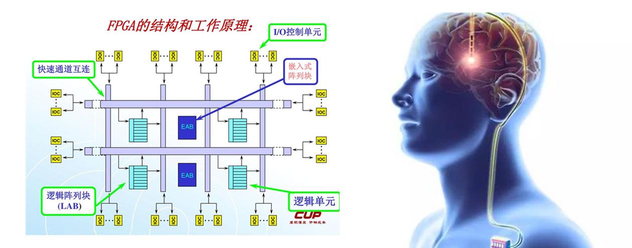 帕金森难题,攻克帕金森的最佳方法