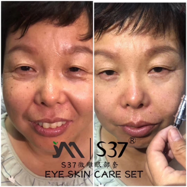 s37微雕眼霜代理,s37微雕眼霜去眼袋