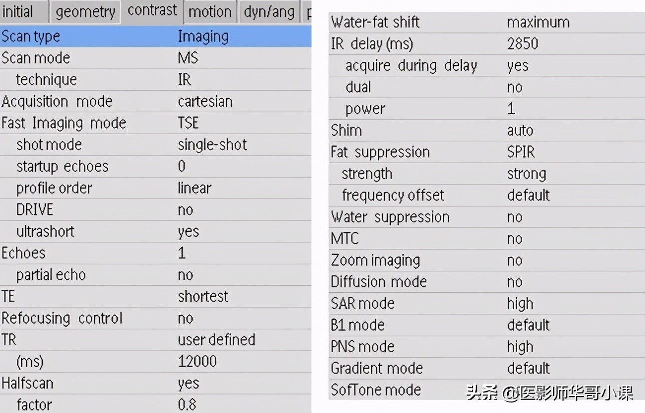 「MRI技术」磁共振伪影分析,了解下SSh_FLAIR序列