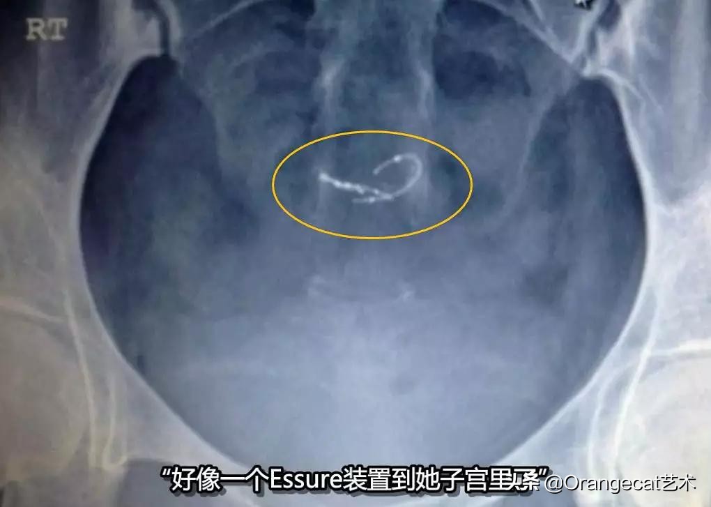 美国尖端医疗纪录片,纪录片尖端医疗