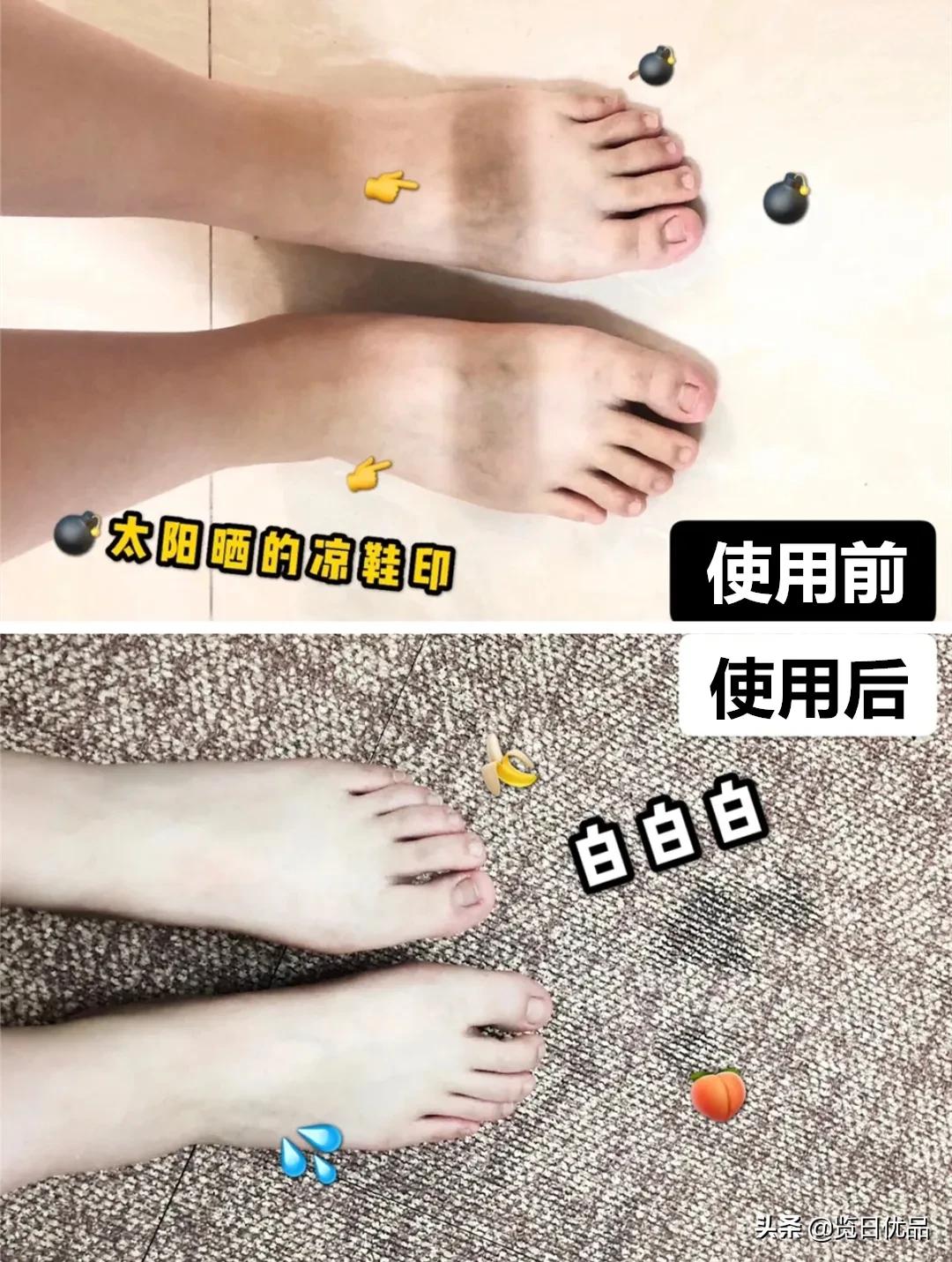 爽炸了!干丑裂的脚皮,一张完整撕掉,敢跟婴儿比姣嫩!