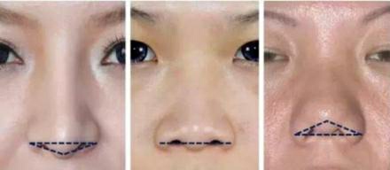 朝天鼻女明星图片,塌鼻好看的明星